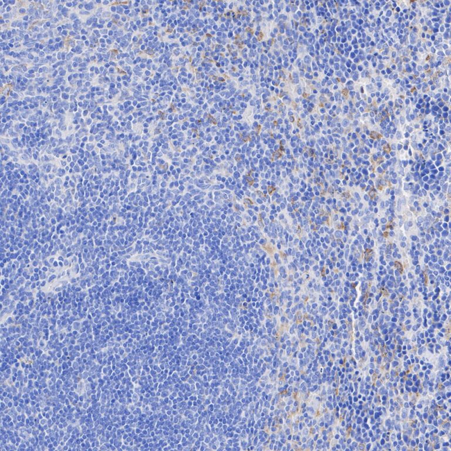 CSF1R Antibody in Immunohistochemistry (Paraffin) (IHC (P))
