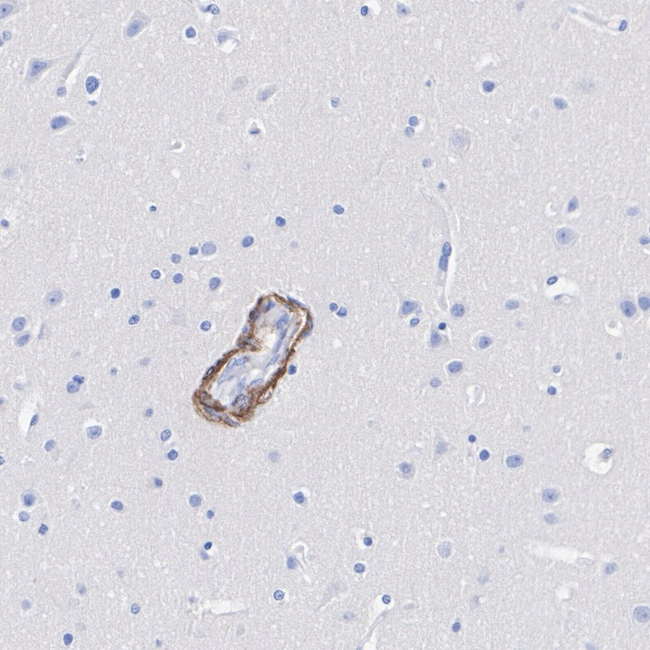 DRD2 Antibody in Immunohistochemistry (Paraffin) (IHC (P))