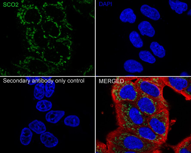 SCO2 Antibody in Immunocytochemistry (ICC/IF)