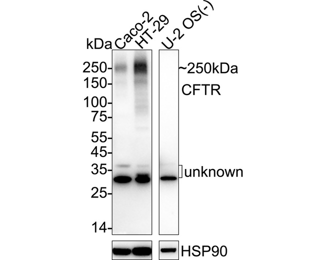 CFTR Antibody in Western Blot (WB)