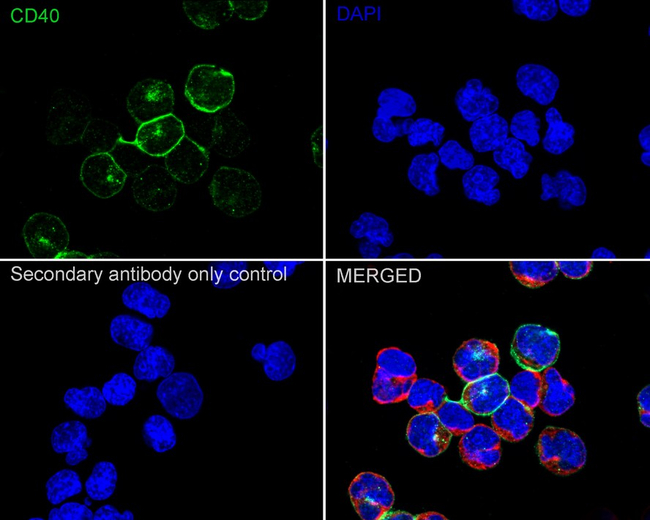CD40 Antibody in Immunocytochemistry (ICC/IF)