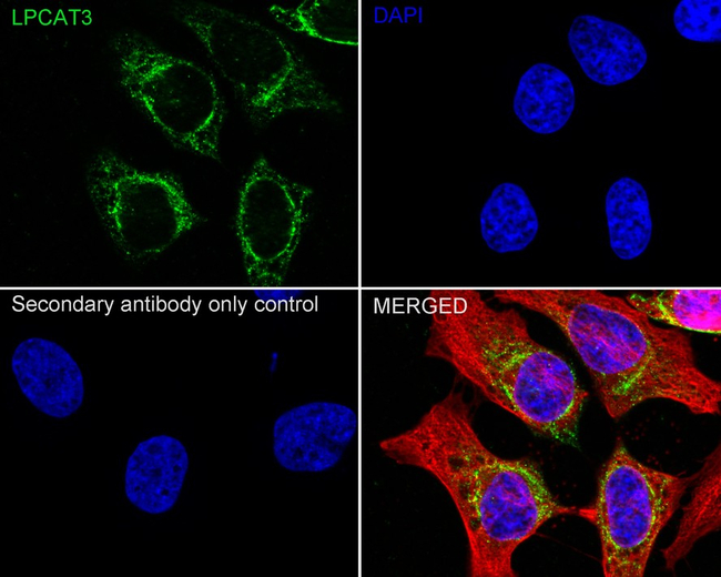 LPCAT3 Antibody in Immunocytochemistry (ICC/IF)