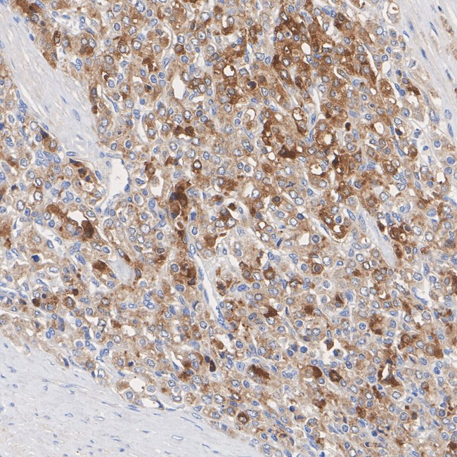 GDF15 Antibody in Immunohistochemistry (Paraffin) (IHC (P))