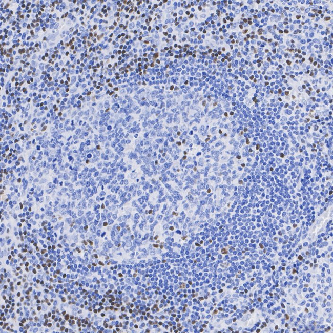 TCF7 Antibody in Immunohistochemistry (Paraffin) (IHC (P))