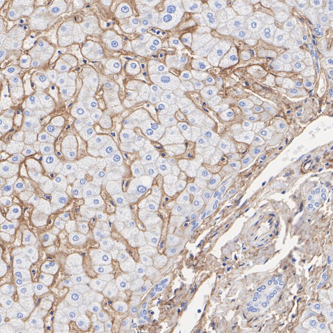 CD81 Antibody in Immunohistochemistry (Paraffin) (IHC (P))