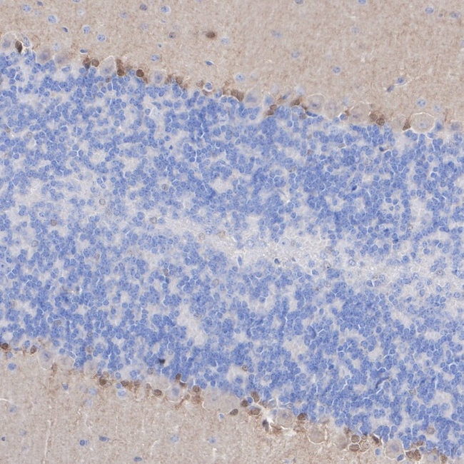 HOPX Antibody in Immunohistochemistry (Paraffin) (IHC (P))