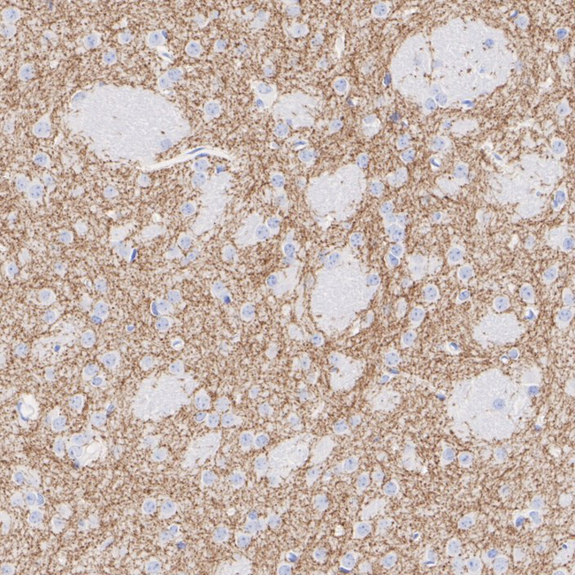 Dopamine Transporter Antibody in Immunohistochemistry (Paraffin) (IHC (P))