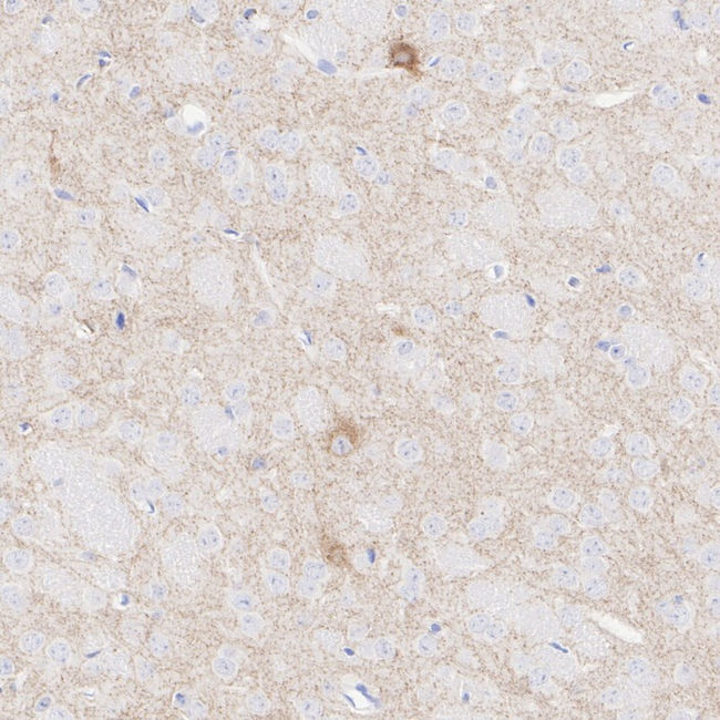 VAChT Antibody in Immunohistochemistry (Paraffin) (IHC (P))