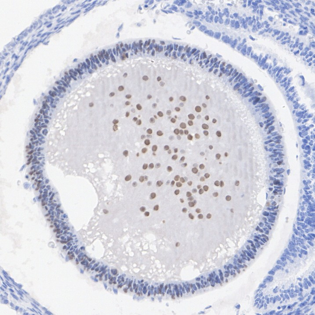 SOX1 Antibody in Immunohistochemistry (Paraffin) (IHC (P))