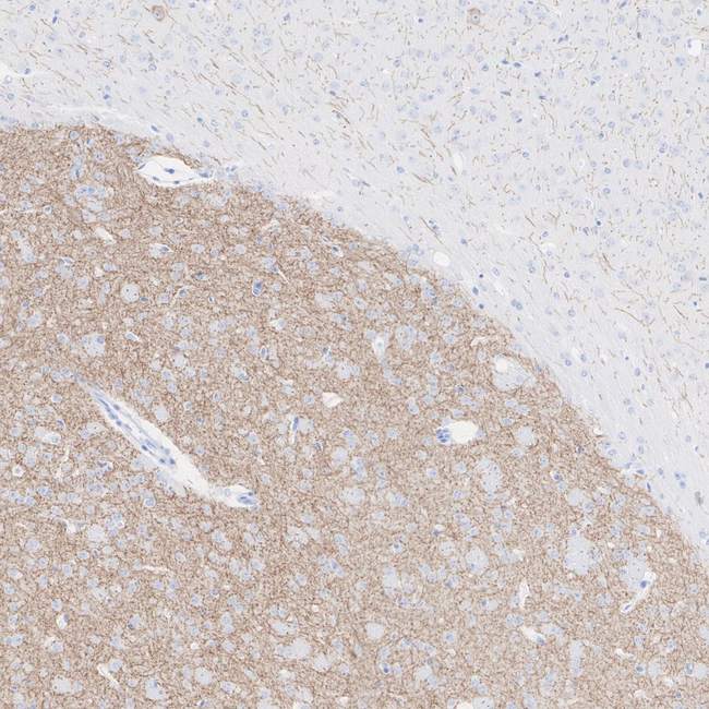 Acetylcholinesterase Antibody in Immunohistochemistry (Paraffin) (IHC (P))