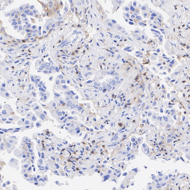 CD48 Antibody in Immunohistochemistry (Paraffin) (IHC (P))