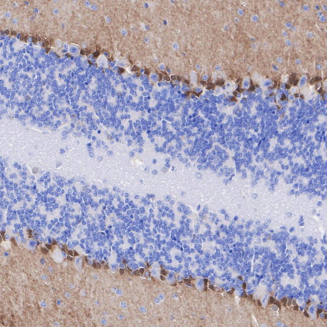 FABP7 Antibody in Immunohistochemistry (Paraffin) (IHC (P))