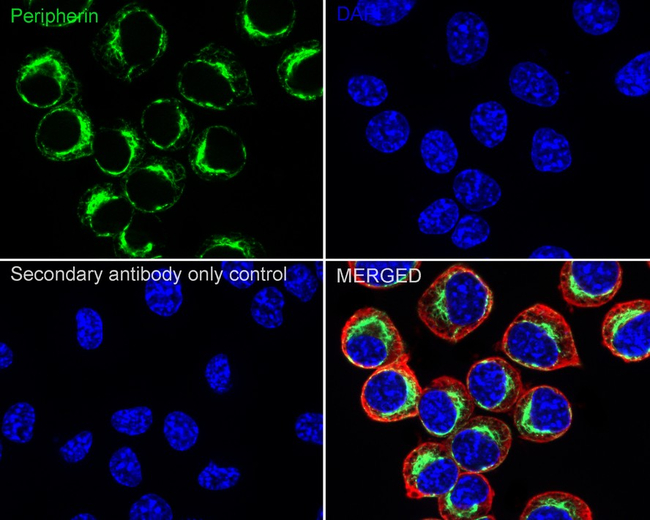 Peripherin Antibody in Immunocytochemistry (ICC/IF)