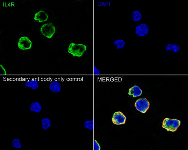 IL4R Antibody in Immunocytochemistry (ICC/IF)
