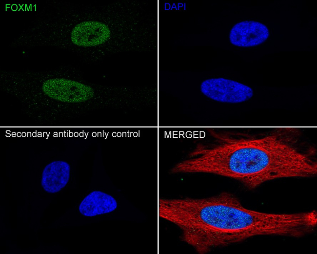 FOXM1 Antibody in Immunocytochemistry (ICC/IF)