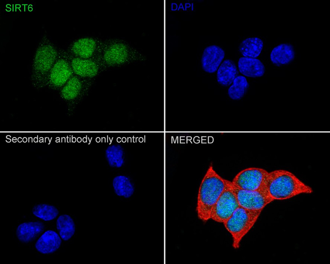SIRT6 Antibody in Immunocytochemistry (ICC/IF)