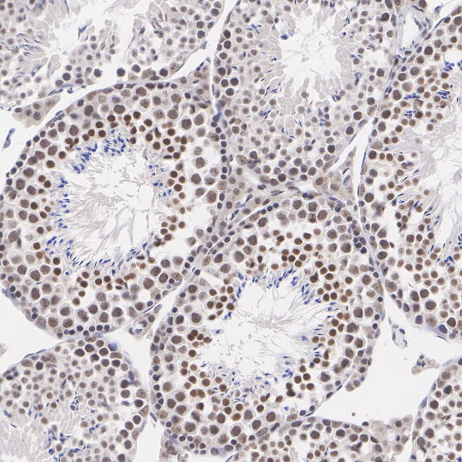 SIRT6 Antibody in Immunohistochemistry (Paraffin) (IHC (P))