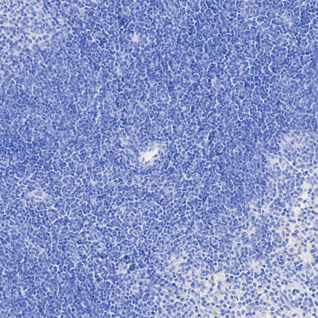 RORA Antibody in Immunohistochemistry (Paraffin) (IHC (P))