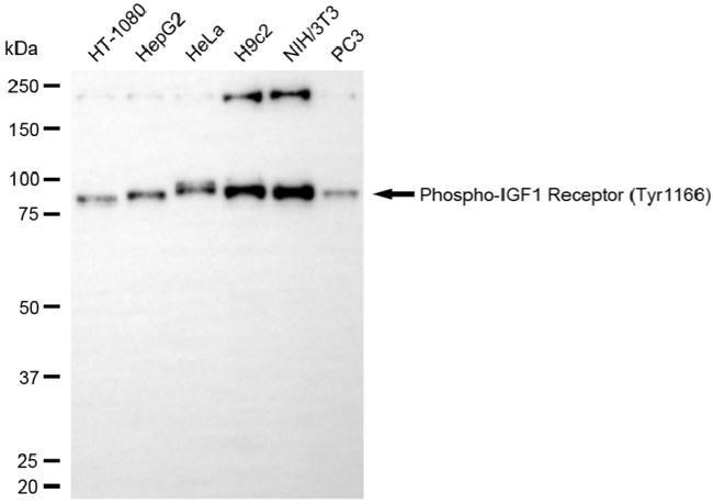 Phospho-IGF1R (Tyr1166) Antibody in Western Blot (WB)