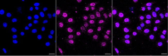 FOXO3A Antibody in Immunocytochemistry (ICC/IF)