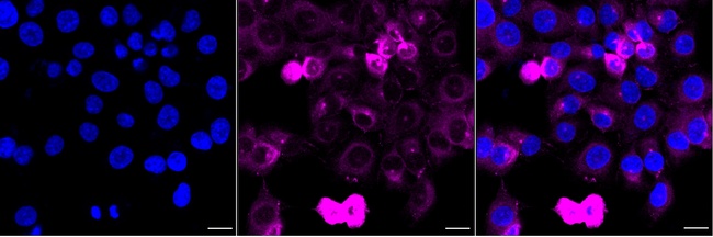 Phospho-Vimentin (Ser72) Antibody in Immunocytochemistry (ICC/IF)