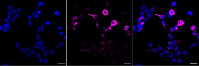 Phospho-Vimentin (Ser56) Antibody in Immunocytochemistry (ICC/IF)