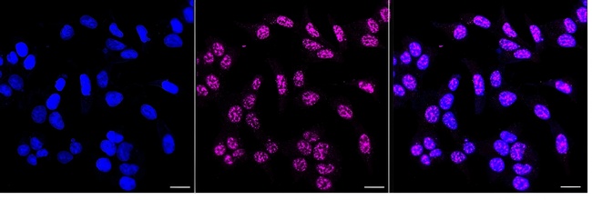 Phospho-SMAD3 (Ser423, Ser425) Antibody in Immunocytochemistry (ICC/IF)
