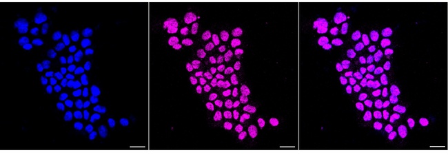 Phospho-PP2A alpha (Tyr307) Antibody in Immunocytochemistry (ICC/IF)