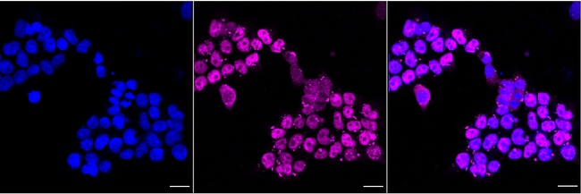 Phospho-p53 (Ser392) Antibody in Immunocytochemistry (ICC/IF)