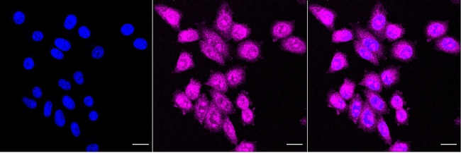 Phospho-TBK1 (Ser172) Antibody in Immunocytochemistry (ICC/IF)