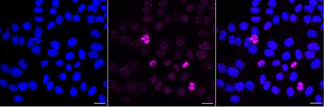 Phospho-Histone H3.3 (Ser31) Antibody in Immunocytochemistry (ICC/IF)