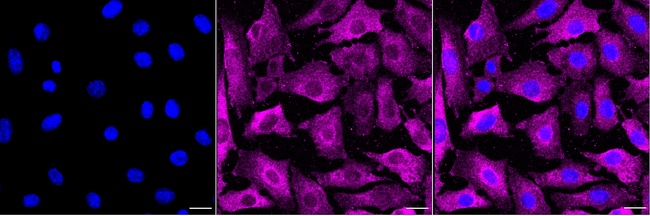 Phospho-eIF4E (Ser209) Antibody in Immunocytochemistry (ICC/IF)