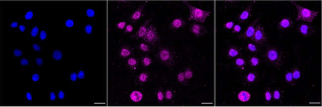 Phospho-EGFR (Tyr1173) Antibody in Immunocytochemistry (ICC/IF)