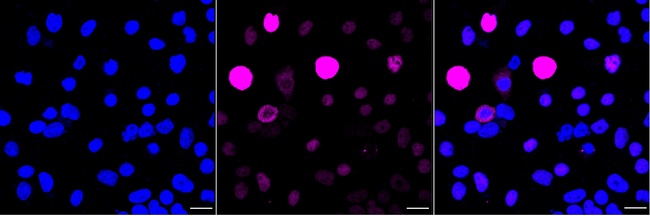 Phospho-c-Myc (Ser62) Antibody in Immunocytochemistry (ICC/IF)