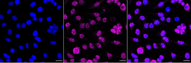Phospho-Chk1 (Ser280) Antibody in Immunocytochemistry (ICC/IF)