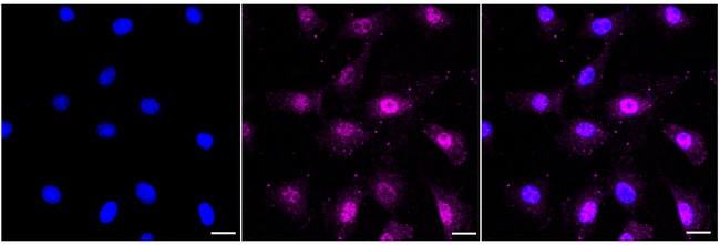 Phospho-AKT1 (Ser124) Antibody in Immunocytochemistry (ICC/IF)