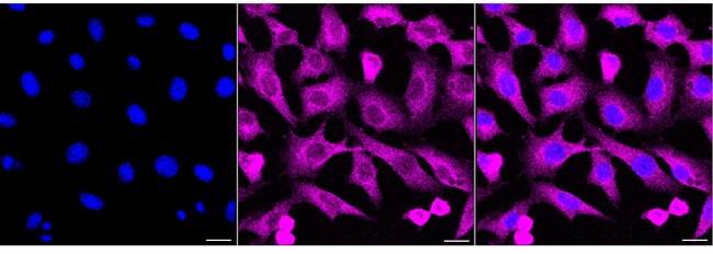 Phospho-Acetyl-CoA Carboxylase (Ser79) Antibody in Immunocytochemistry (ICC/IF)