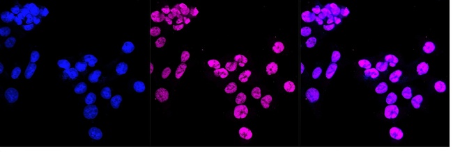 Phospho-Rb (Ser780) Antibody in Immunocytochemistry (ICC/IF)
