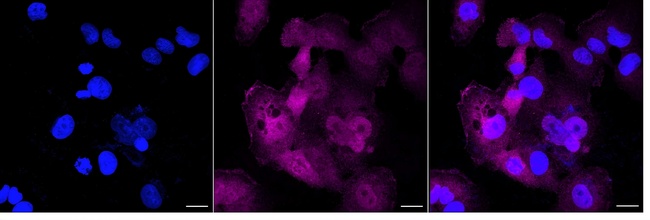 PLCG1 Antibody in Immunocytochemistry (ICC/IF)