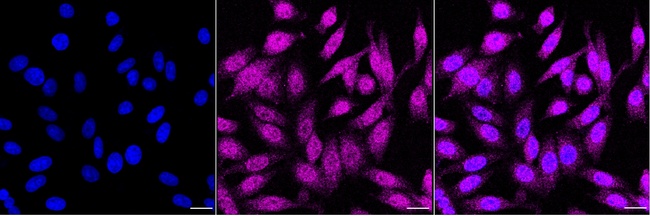 PLCG1 Antibody in Immunocytochemistry (ICC/IF)