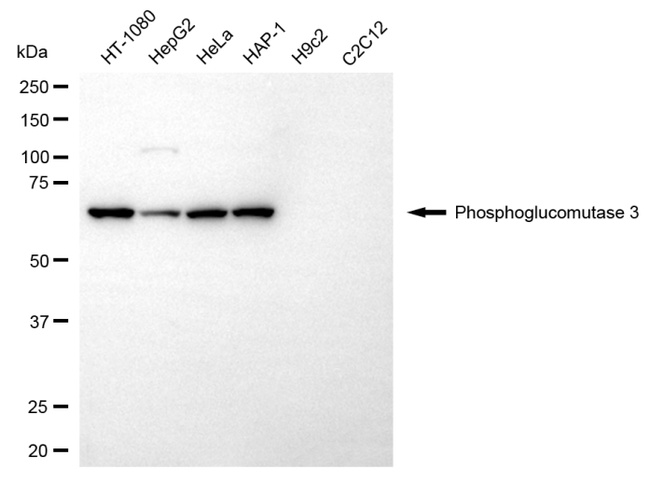 PGM3 Antibody in Western Blot (WB)