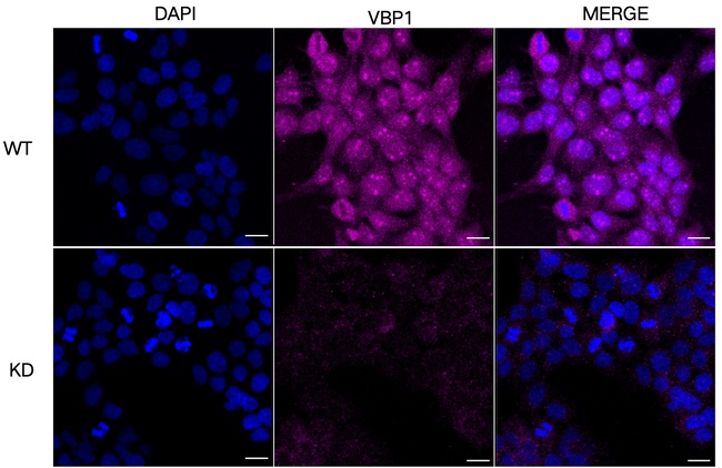 VBP1 Antibody in Immunocytochemistry (ICC/IF)