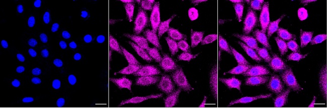 VAV2 Antibody in Immunocytochemistry (ICC/IF)