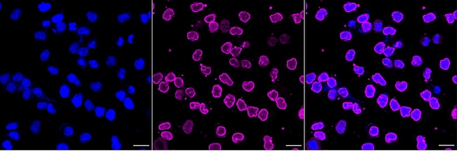 USP11 Antibody in Immunocytochemistry (ICC/IF)