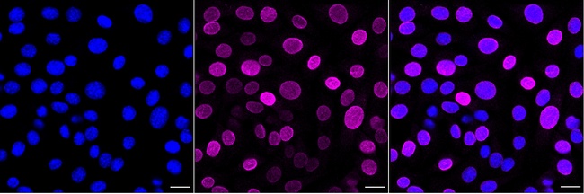 UNC84B Antibody in Immunocytochemistry (ICC/IF)