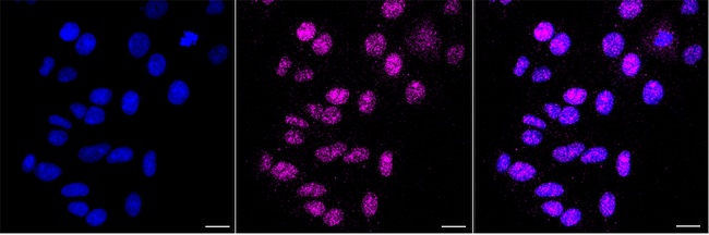 UHRF2 Antibody in Immunocytochemistry (ICC/IF)