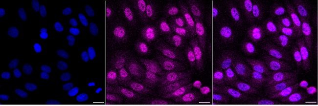 UCH37 Antibody in Immunocytochemistry (ICC/IF)