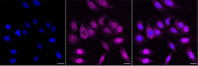 UCH37 Antibody in Immunocytochemistry (ICC/IF)