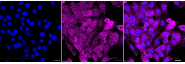 TK1 Antibody in Immunocytochemistry (ICC/IF)