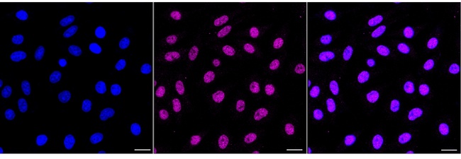 TCF7L2 Antibody in Immunocytochemistry (ICC/IF)